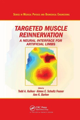 Targeted Muscle Reinnervation A Neural Interface for Artificial Limbs Buch 2017