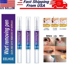 4× Painless Wart Remover Pen Eliminate Skin Tag Foot Corn Mole Warts Restoration