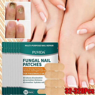 32~320Patches Fungal Nail Patches For Damaged Nails Foot Nails Repair Nail Care