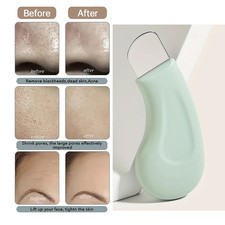 Blackhead and Whitehead Removal Tool for Nose and Face Skin Care Tool for Women