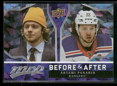 2021-22 Upper Deck MVP - Before and after Artemi Panarin #BA-8
