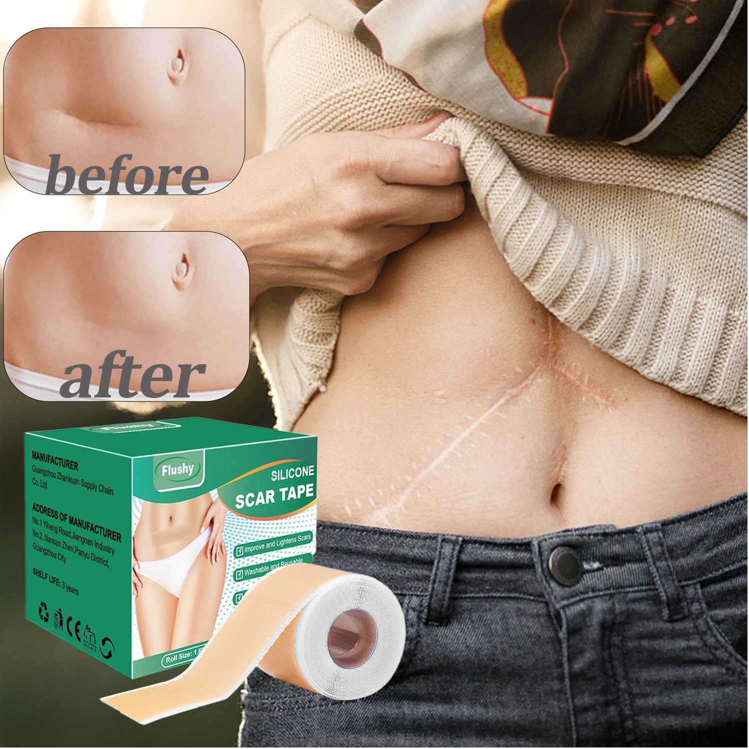 Silicone Scar Sheets & Tape Roll 1.6x59 Inch for Keloid Acne Scar Removal