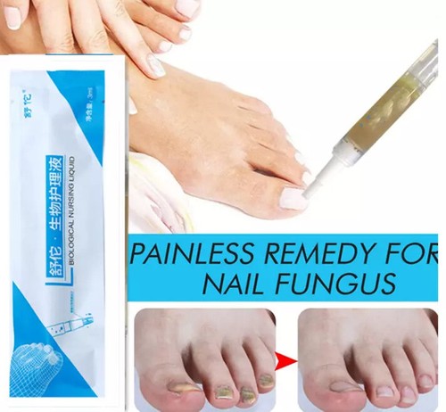 New 8X Toenail Fungus Treatment Pen, Okita Fungi Nail Fungus Remover 2025 - Picture 3 of 13