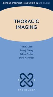 Thoracic Imaging, Paperback by Desai, Sujal R.; Copley, Susan J.; Aziz, Zelen...
