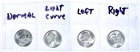 2026 Emerging Liberty Dimes Die cud Errors  (4-Coin Error Set) 2026 P-Mint
