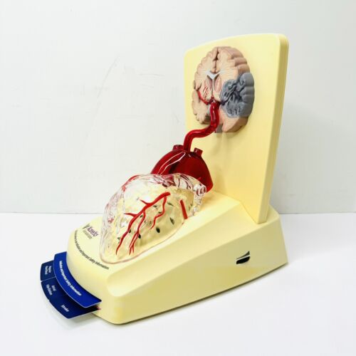 Xarelto Medical Advertising 3D Human Heart/brain Display Model DRUG REP - Picture 2 of 7