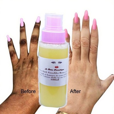 Dark Knuckle Cleanser  For Knuckles, Knees and toes