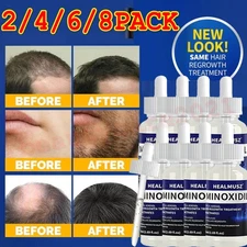Minoxidil 5% Hair Regrowth Treatment Topical Solution for Men 2-8 Month Supply