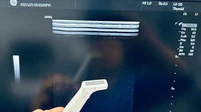 GE L8-18i - D Hockey Stick probe from 2022