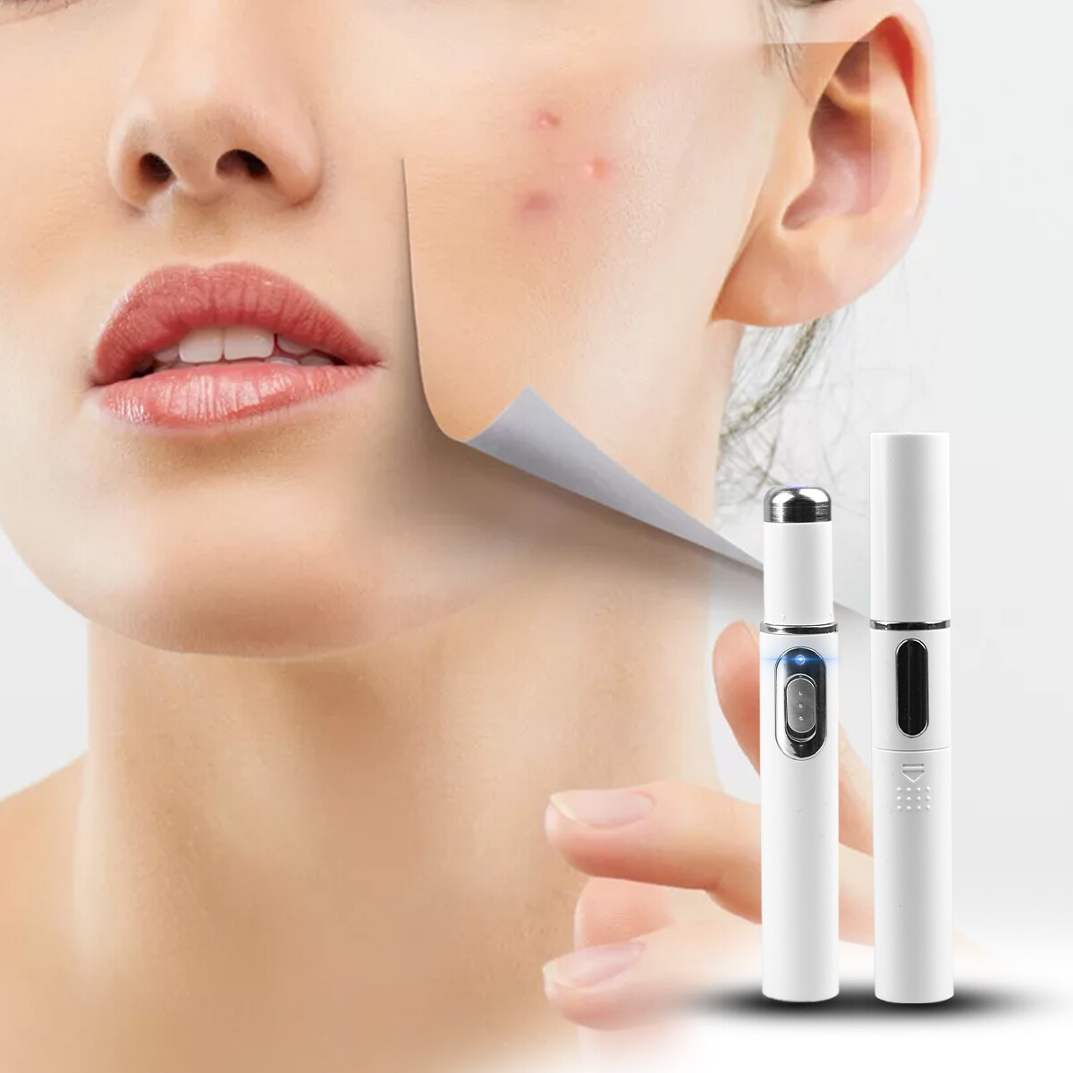 Blue Light Therapy Pen for Spider Veins Acne Removal Pen Scar Wrinkles