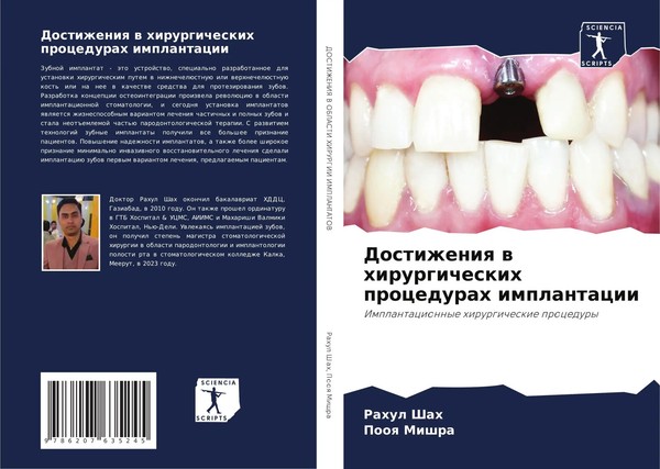 Rahul Shah (U. A.) | Dostizheniq W Hirurgicheskih Procedurah Implantacii | Buch-image