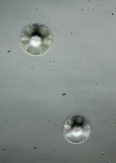 Antique microscope slide. Diatoms. Symbolophora trinitatis. Sysram Russia.