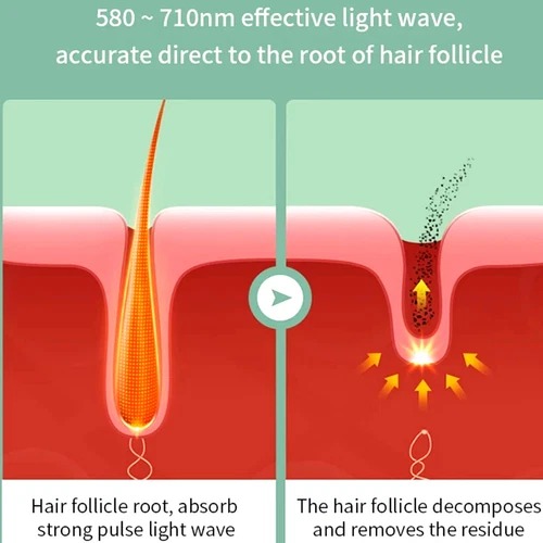 990000 Flashes Electric Depiladora Laser Permanent IPL Laser Hair Removal Device - Picture 5 of 24