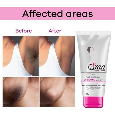 Qraa Advanced Lacto Dark Underarm Cream for brighten underarm 50 g