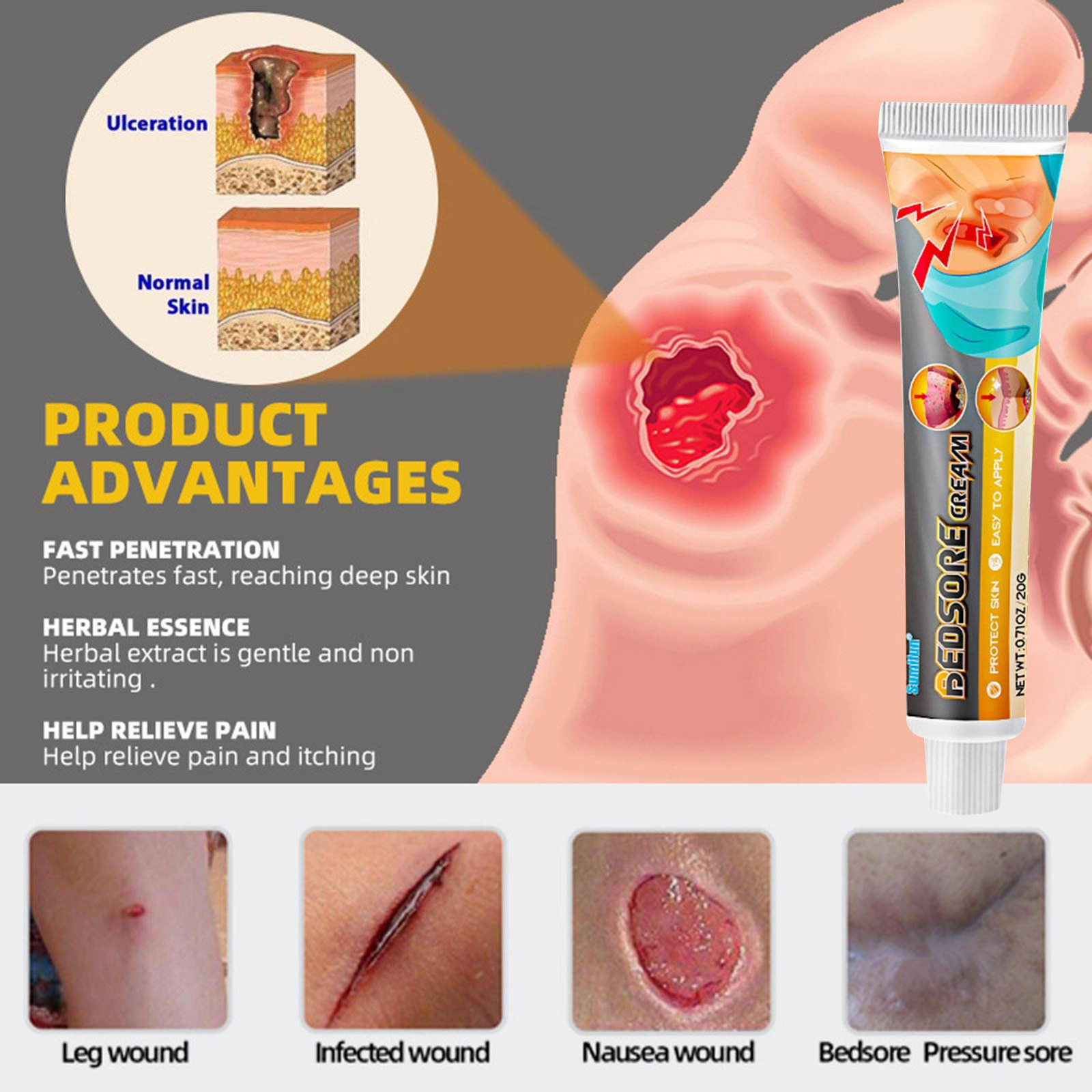 2PCS Bed Sore Cream Bedsore Ointment Bed Sores Treatment BEST Wound Healing eBay