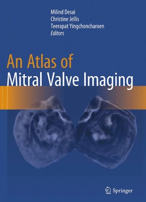 Milind Desai (u. a.) | An Atlas of Mitral Valve Imaging | Taschenbuch | Englisch