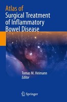 Atlas Of Surgical Treatment Of Inflammatory Bowel Disease Tomas M. Heimann