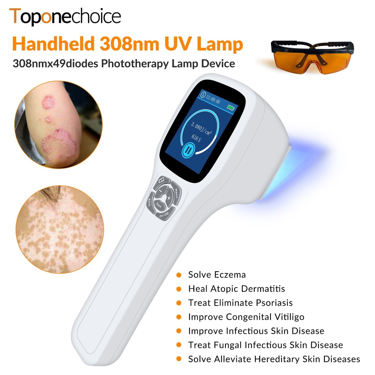 ボディ・フェイスケア UVB LIGHT THERAPY DEVICE UL-01 308nm Amazon.com: 308nm UVB Excimer Light Device with XeCl Lamp
