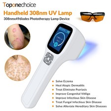 308nm Narrowband UVB Light UV Light Therapy UV Light for Skin Treatment