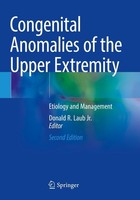 Congenital Anomalies Of The Upper Extremity Donald R. Laub Jr.