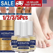 Nail-Aid Keratin 3Day Growth Nail Treatment Strengthener, 15ml 0.55 FlOz