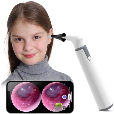 Otoscope with Light, Otoscope w/Dual View, 720pHD WiFi Ear Scope w/ 6 Lights,...