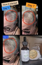 Hair Growth Oil And Shampoo. ORGANIC.