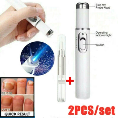 MARKENLOS Laser Stift Anti-Pilz Nagel Behandlung Finger Behandlung Pen Nail Treatment DE