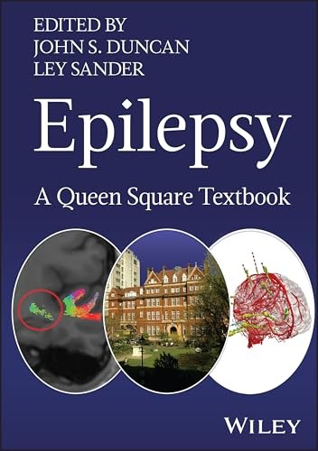 Epilepsy: A Queen Square Textbook - Image 3