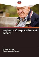 Arpita Gupta (U. A.) | Implant - Complications Et éChecs | Taschenbuch (2024)