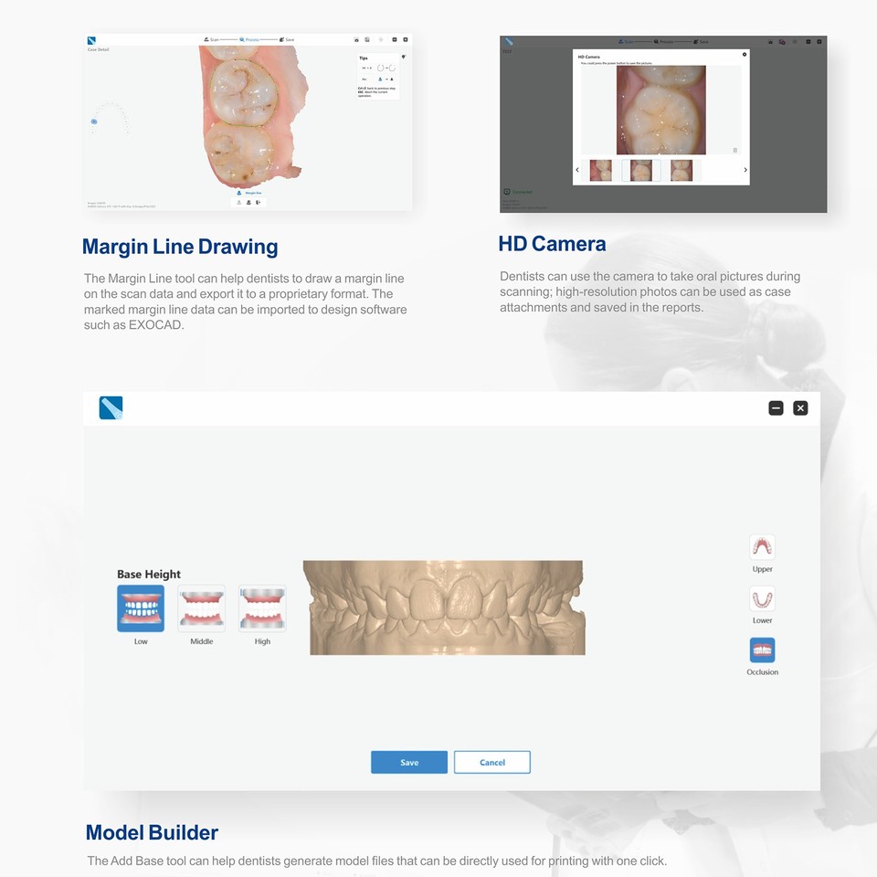 Dental Intraoral Scanner for CAD/CAM Dentistry 3D Scanner + Free ...