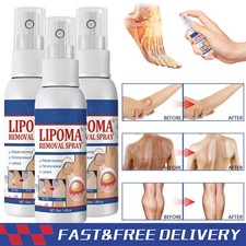 1-5PC Lipomheilung Reduction Spray,Instant LumpFree Lipoma Removal Spray USA Hot