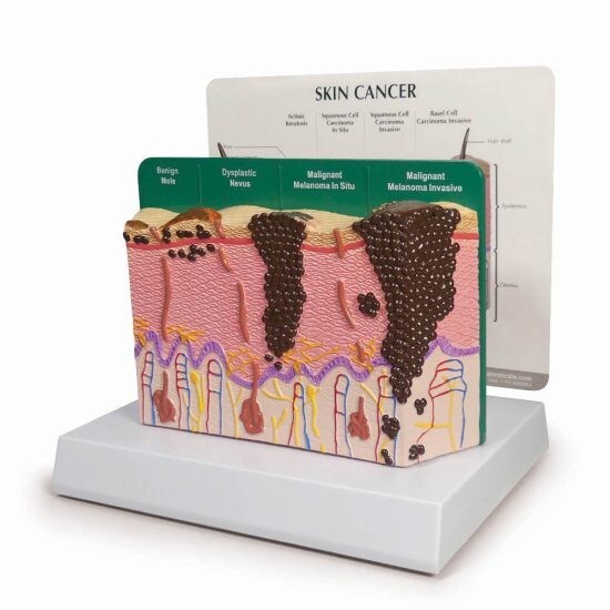 Melanoma Cáncer de Piel Modelo Anatómico GPI LFA #3855 VER VIDEO ¡Haznos una Oferta!