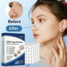 720Pcs Skin Tag Remover Patches Quick Effective Mole Wart Removal Pad Sticker