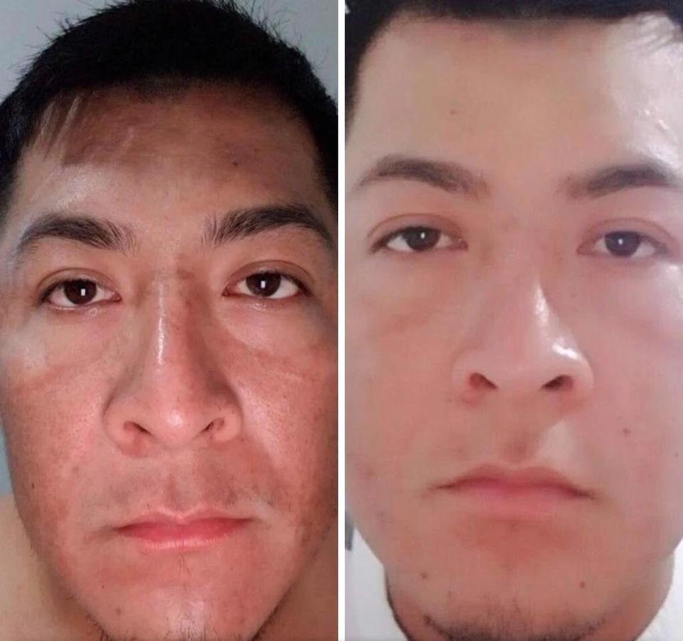 WHITE FADE SUPER SKIN LIGHTENER; PARA REMOVER MANCHAS OSCURAS DE LA PIEL, 2oz - Image 4 of 4