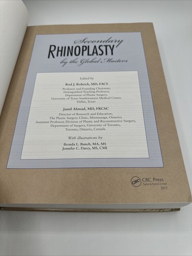 Secondary Rhinoplasty: By the Global Masters - Two Volume - Foto 7 di 12
