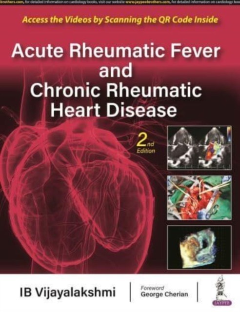 Acute Rheumatic Fever and Chronic Rheumatic Heart Disease by IB Vijayalakshmi
