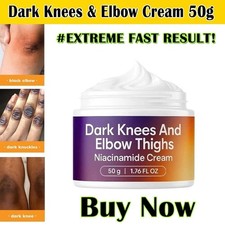 New Strong Whitening Cream For Removing Dark Knuckle Finger Elbow and Knee NEW