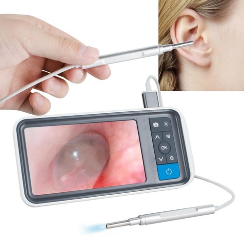 Rechargeable Digital Otoscope 39mm Lens with Color Display Ear Wax Removal Tool - Picture 1 of 9