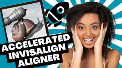 Viber125 High Frequency Vibrations   Accelerate Aligners, Invi$align, Retention