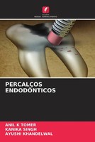 Anil K Tomer (U. A.) | PercalÇOs EndodÔNticos | Taschenbuch | Portugiesisch