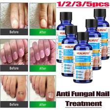 ANTI-FUNGAL MAXIMUM STRENGTH TOENAIL FUNGUS ATHLETES FOOT FUNGI NAIL SUPPORT US