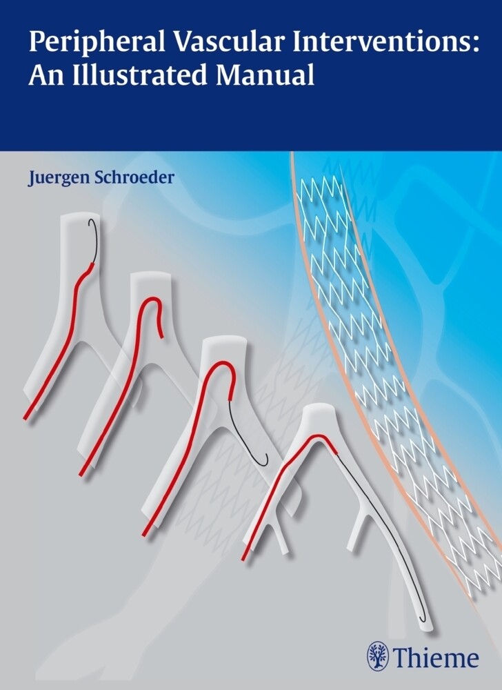 Thumbnail - Peripheral Vascular Interventions: An Illustrated Manual | Jürgen