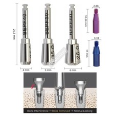 Tornillo guía perfilador óseo Dental ET 4.0-6.0 mini ajuste regular OSS Hiossen