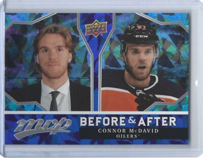 2021-22 Upper Deck MVP Before and After #BA-2 Connor McDavid  