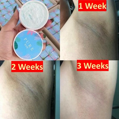 6x PURE UNDERARM Care Clear Armpit KNEE BUTTOCKS Deodorant Body Skin 50g - Picture 3 of 12