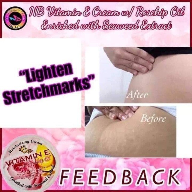 rosehip oil for cellulite