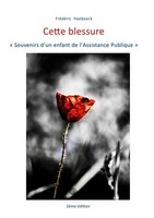 FréDéRic Hoebeeck | Cette Blessure | Taschenbuch | FranzöSisch (2025)