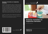 Rajesh K. S. (U. A.) | Avances Recientes En Implantes Dentales | Taschenbuch