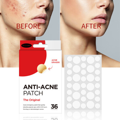ANTI-ACNE PATCH 36 grain PATCH colloidal clear invisible acne patch